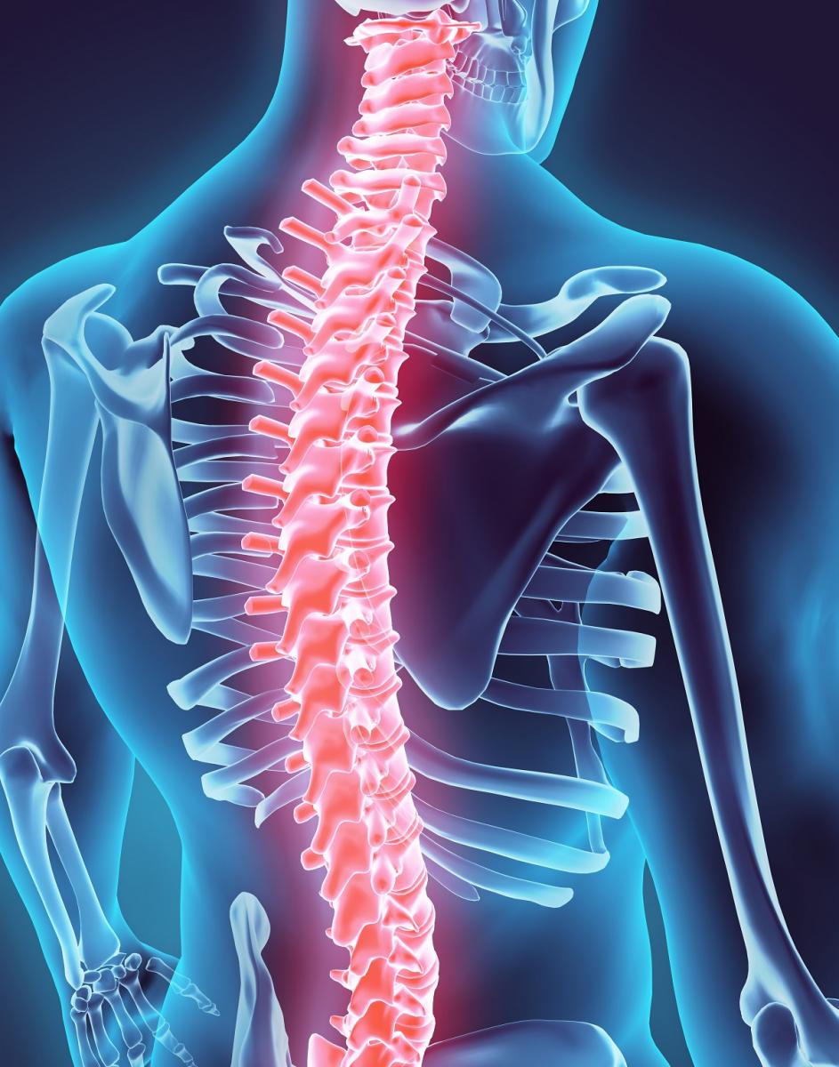 What Is The Term For A Partial Or Complete Severing Of The Spinal Cord